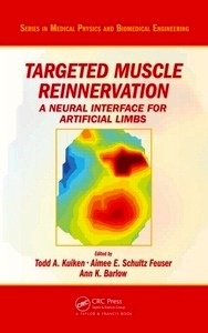 Targeted Muscle Reinnervation "A Neural Interface for Artificial Limbs"