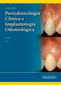 Periodontología Clínica e Implantología Odontológica Vol. 2