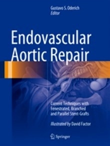 Endovascular Aortic Repair "Current Techniques with Fenestrated, Branched and Parallel Stent-Grafts"