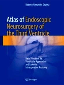 Atlas of Endoscopic Neurosurgery of the Third Ventricle "Basic Principles for Ventricular Approaches and Essential Intraoperative Anatomy"