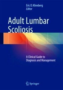 Adult Lumbar Scoliosis "A Clinical Guide to Diagnosis and Management"