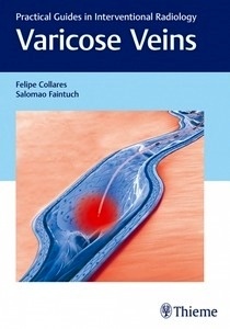 Varicose Veins "Practical Guides in Interventional Radiology"