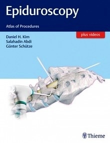 Epiduroscopy "Atlas of Procedures"