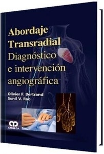 Abordaje Transradial "Diagnóstico e Intervención Angiográfica"