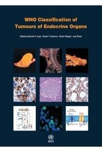 WHO Classification Of Tumours Of Endocrine Organs