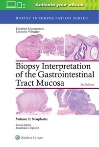 Biopsy Interpretation of the Gastrointestinal Tract Mucosa "Volume 2: Neoplastic"