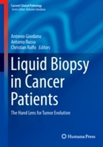 Liquid Biopsy in Cancer Patients "The Hand Lens for Tumor Evolution"
