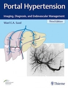 Portal Hypertension "Imaging, Diagnosis, and Endovascular Management"