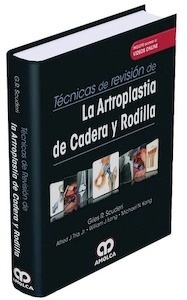 Técnicas de Revisión de la  Artroplastia de Cadera y Rodilla