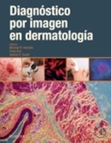 Diagnóstico por Imágen en Dermatología
