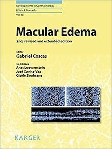 Macular Edema "A Practical Approach"