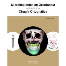 Microimplantes en Ortodoncia aplicada a la Cirugía Ortognática