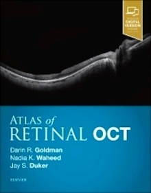 Atlas of Retinal OCT "Optical Coherence Tomography"