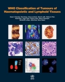 WHO Classification of Tumours of Haematopoietic and Lymphoid Tissues "Volume 2"