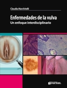 Enfermedades de la Vulva. un Enfoque Interdisciplinario