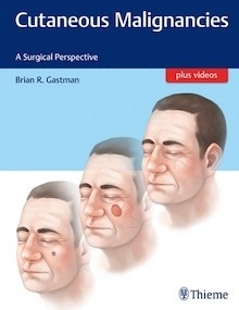 Cutaneous Malignancies "A Surgical Perspective"