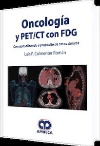 Oncología y PET/CT con FDG "Conceptualizando a Proposito de  de Casos Clínicos"