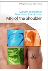 MRI Of The Shoulder