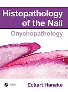 Histopathology of the Nail "Onychopathology"