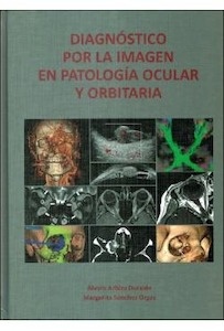 Diagnóstico por la Imagen en Patología Ocular y Orbitaria