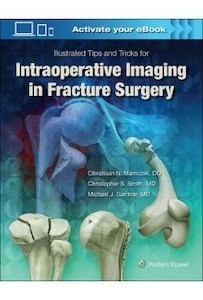 Illustrated Tips And Tricks For Intraoperative Imaging In Fracture Surgery