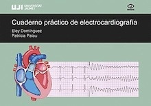 Cuaderno Práctico de Electrocardiografía