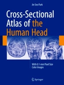 Cross-Sectional Atlas of the Human Head "With 0.1-mm pixel size color images"