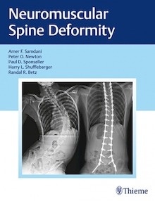 Neuromuscular Spine Deformity "A Harms Study Group Treatment Guide"