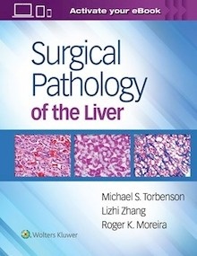 Surgical Pathology of the Liver