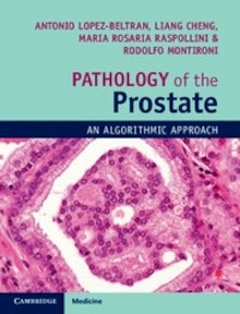 Pathology of the Prostate "An Algorithmic Approach"