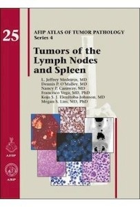 Tumors of the Lymph Node and Spleen Vol.25 "AFIP Atlas of Tumors"