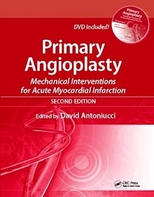 Primary Angioplasty "Mechanical Interventions For Acute Myocardial Infaction"