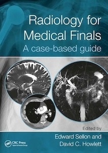 Radiology for Medical Finals "A case-based guide"