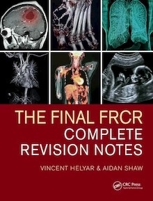 The Final FRCR "Complete Revision Notes"