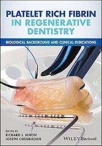 Platelet Rich Fibrin in Regenerative Dentistry "Biological Background and Clinical Indications"