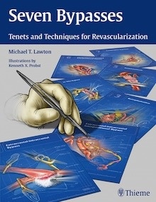 Seven Bypasses "Tenets and Techniques for Revascularization"