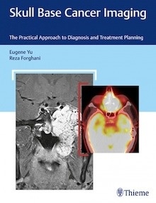 Skull Base Cancer Imaging "The Practical Approach to Diagnosis and Treatment Planning"