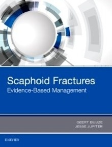 Scaphoid Fractures "Evidence-Based Management"