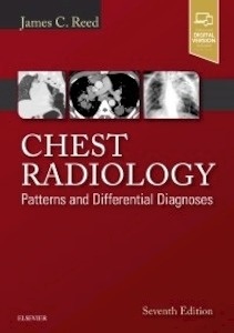 Chest Radiology "Patterns and Differential Diagnoses"