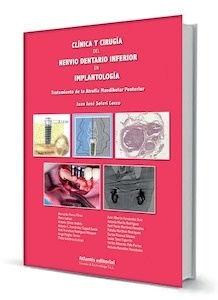 Clínica y Cirugía del Nervio Dentario Inferior en Implantología "Tratamiento de la Atrofia Mandibular Posterior"