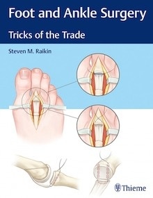 Foot and Ankle Surgery "Tricks of the Trade"