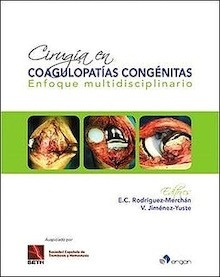 Cirugía en Coagulopatías Congénitas "Enfoque Multidisciplinario"