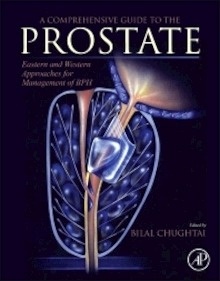 A Comprehensive Guide to the Prostate "Eastern and Western Approaches for Management of BPH"