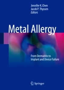 Metal Allergy "From Dermatitis to Implant and Device Failure"