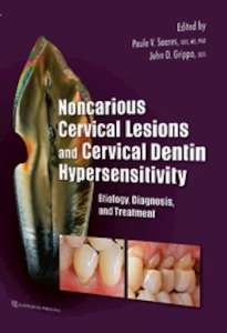 Noncarious Cervical Lesions and Cervical Dentin Hypersensitivity Etiology, Diagnosis, and Treatment