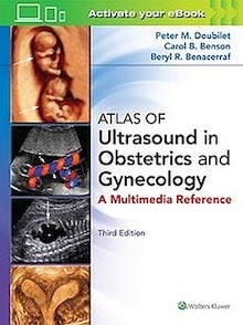 Atlas of Ultrasound in Obstetrics and Gynecology "A Multimedia Reference"