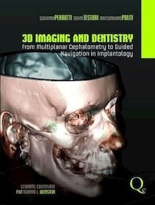 3D Imaging And Dentistry "From Multiplane Cephalometry To Guided Navigation In Implantology"