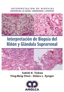 Interpretación de Biopsia del Riñón y Glándula Suprarrenal