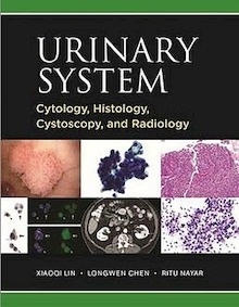 The Urinary System "Cytology, Histology, Cystoscopy, And Radiology"