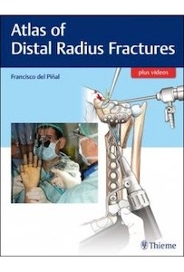 Atlas Of Distal Radius Fractures